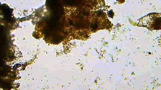 Ciliate Protozoa