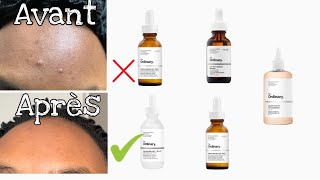 MA ROUTINE THE ORDINARY, mon avis sur les produits