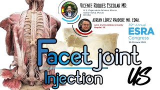 FACET JOINT INJECTION (ESRA 2022 VIDEO CONTEST.THESSALONIKI)