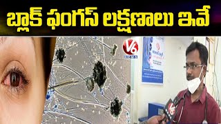 Neuro Physician Dr Rakesh Reddy Face to Face About Black Fungus Symptoms | V6 News