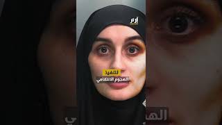 امرأة تلقي قنبلة حارقة على سيارة حماتها