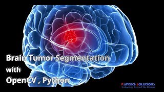 Brain Tumor Segmentation with OpenCV-python