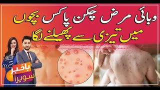 Chickenpox in Children : Symptoms, Diagnosis and Treatment | Watch video