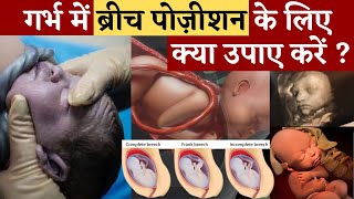 गर्भ में ब्रीच पोज़ीशन के लिए क्या उपाए करें ? Tips for BREECH BABY To Normal - जरूर देखें