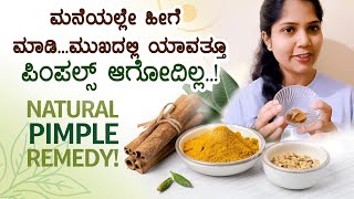 ಮನೆಯಲ್ಲೇ ಹೀಗೆ ಮಾಡಿ ಯಾವತ್ತೂಪಿಂಪಲ್ಸ್ ಆಗೋದಿಲ್ಲ| How to remove pimples on face at homemade | Priya Gowda