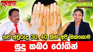 තව අවුරුදු 30, 40 කින් අපි ඔක්කොම සුදු කබර රෝගීන්   Aruna lk   Derana Aruna