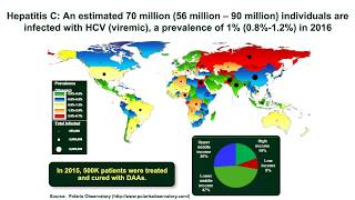 The Role of Non Invasive Biomarkers in Managing Patients with HCV