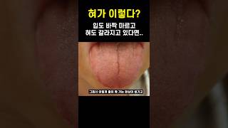 혀 갈라지고 입마름이 있으신 분들은 이렇게 해보세요. #혀갈라짐 #입마름