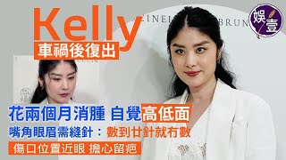 陳慧琳足本訪問︱Kelly車禍後復出 花兩個月消腫 自覺高低面 嘴角眼眉需縫針：數到廿針就冇數 傷口位置近眼 擔心留疤（ #陳慧琳 #Kelly #娛壹 ）