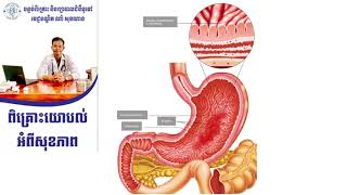 ការព្យាបាលជំងឺក្រពះដោយថ្នាំ Phosphalugel វេជ្ជ. ណាំ សុខណាង Dr.Nam Soknang