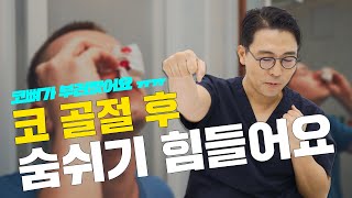 172화. 코뼈 부러진 후 숨쉬기가 힘들어요 ㅠㅠ