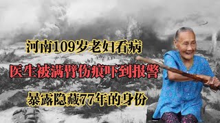 109岁老妇看病，满臂伤痕吓得医生报警，得知真相令警察肃然起敬