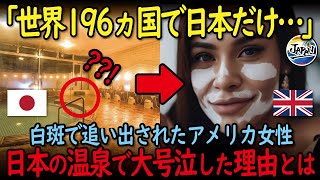 【海外の反応】「世界196カ国で日本だけでした…」白斑で追い出されたアメリカの女性、人生で初めて訪れた日本の温泉で大号泣した理由