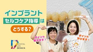 【インプラントのセルフケア指導について教えてください】今更聞けない歯科知識 新人歯科衛生士さんのためのお悩み相談室/萬田久美子先生