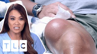 Dr. Lee Removes The BIGGEST Cyst She Has Ever Seen! I Dr. Pimple Popper: Pop Ups