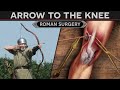 Treating an Arrow to the Knee! - Roman Surgery Techniques DOCUMENTARY