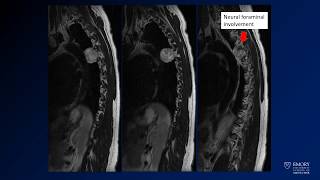 Neuroradiology board review lecture 1 case 18