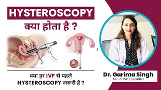 Hysteroscopy  क्या होता है ? क्या हर IVF से पहले Hysteroscopy जरूरी है? | Dr. Garima | Baby Joy IVF