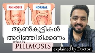 ആൺകുട്ടികൾ പേടിക്കേണ്ട കാര്യം 🍌🍌| complete doubts on ഫിമോസിസ് | Home remedy