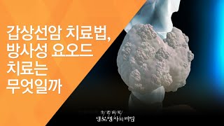 갑상선암 치료법, 방사성 요오드 치료는 무엇일까 - (2010.4.15_329회 방송)_천의 얼굴, 갑상선질환