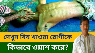 সরাসরি দেখুন বিষ খাওয়ার রোগীকে কিভাবে ওয়াস করে