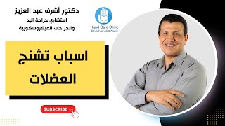 اسباب تشنج العضلات / دكتور أشرف عبد العزيز