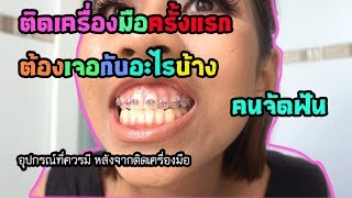 ติดเครื่องมือจัดฟันครั้งแรก 5วัน ผ่านไป รู้สึกยังไง  รีวิวอุปกรณ์ที่ใช้สำหรับคนจัดฟัน