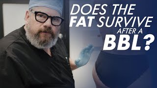 Does the FAT Survive After a BBL?