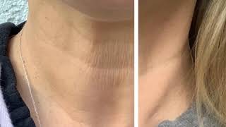 Best Necklift Cream from Sente · Rancho Cucamonga, Chino Hills, Riverside · Gemini Plastic Surgery