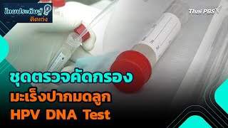 ชุดตรวจคัดกรองมะเร็งปากมดลูก HPV DNA Test | ไทยประดิษฐ์คิดเก่ง