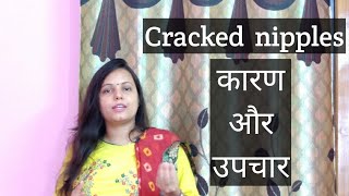Cracked nipples cause and treatment ( problems during breastfeeding)