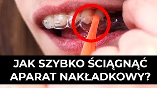 Aparat nakładkowy Secret Ortho- jak szybko ściągnąć?