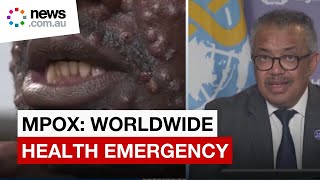 Mpox: public health emergency of international concern declared