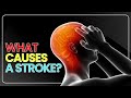 What Causes a Stroke ?