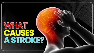 What Causes a Stroke ?