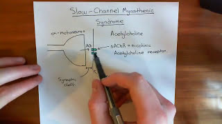 Slow-Channel Congenital Myasthenic Syndrome (SCCMS) Part 1