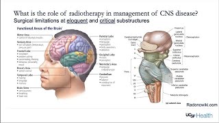 Central Nervous System Radiotherapy and Radiosurgery