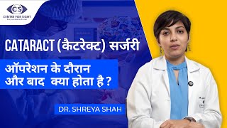 What to Expect After Cataract Surgery | Dr. Shreya Shah on Recovery \u0026 Precautions