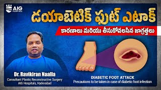 Diabetic Foot Attack | World Diabetes Day | AIG Hospitals