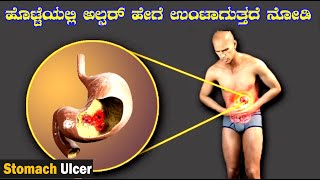 What causes a stomach ulcer? Animation in Kannada Top interesting facts in Kannada