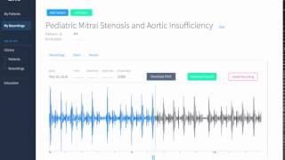 Pediatric Mitral Stenosis and Aortic Insufficiency Recording \u0026 Waveform | Eko Health