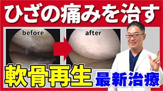 【軟骨再生】 膝の痛みを治す！ひざ関節症 手術しかない？ 最新の再生医療を解説！