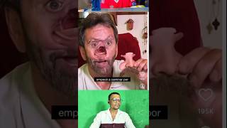 Try Not To Laugh 😂 209 #funny #funnyvideo #memes #shorts