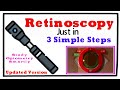 Updated- Retinoscopy just in 3 Simple Steps