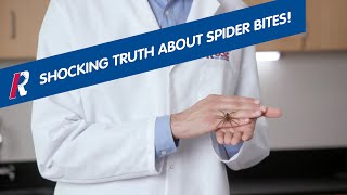 The Shocking Truth About Spider Bites!