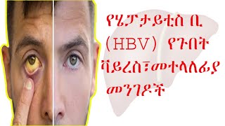 የሄፓታይቲስ ቢ (HBV) የጉበት ቫይረስ፣አጋላጭ ሁኔታዎችና መተላለፊያ መንገዶች/ HBV: Transmission and Risk Factors