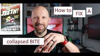 How to Fix a Collapsed Bite