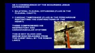 Dr. Richard Kent  - The Crucifixion of Jesus Christ (2011 - updated)