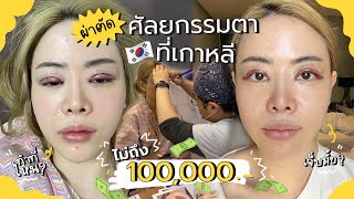 ผ่าตัดศัลยกรรมตาที่เกาหลี EP.2 ไม่ถึง100,000บาท Beauty Surgery | Jane Soraya