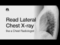 How to Read a Lateral Chest X-Ray